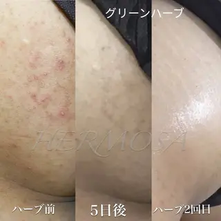 オールハンド フェイシャルのエステ・リラクイメージ