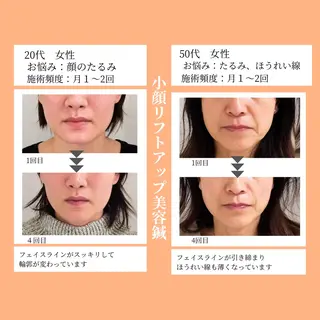 小顔・ツルツル素肌 ハリステリアのエステ・リラクイメージ