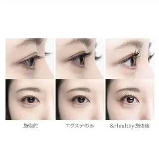 ãããšã¯ã»ããã ð·ðððð ãã€ãžãŒã®ãããšã¯ã»ããããã¶ã€ã³