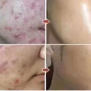 マツエク・マツパ 愛維美水光美肌専門店所属・愛維美水光美肌専門店 メンズレディースokのエステ・リラクイメージ