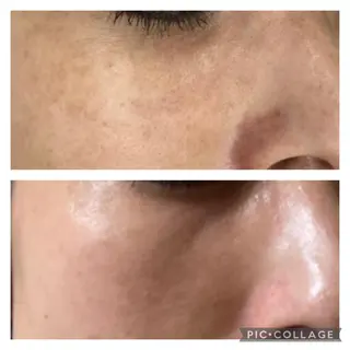 山元 光絵のエステ・リラクイメージ