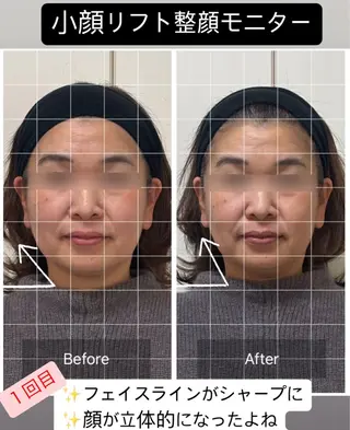 小顔リフト整顔/ 美肌サロンのその他イメージ