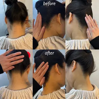 うなじ脱毛/美肌脱毛 LABELのエステ・リラクイメージ