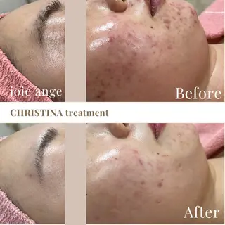 フェイシャル/脱毛 ジョアアンジェ さきのエステ・リラクイメージ