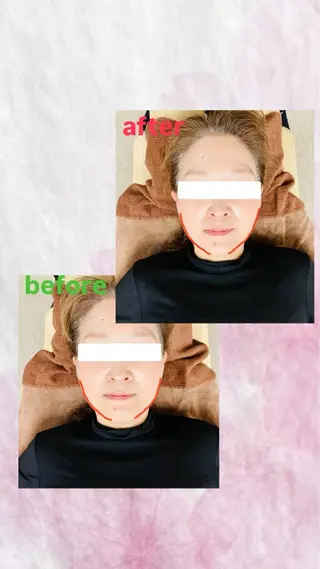 Arch整骨院所属・脳と関節から整える Arch整骨院のエステ・リラクイメージ