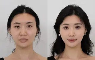 カラー aliaハイフ&水光ジェットサロン所属・aliaハーブ水光店 エステティシャン募集のエステ・リラクイメージ