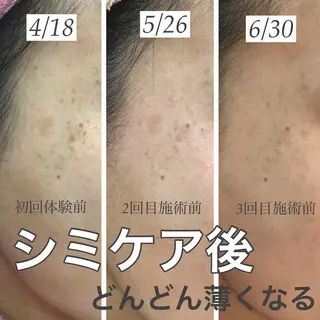 【しみ毛穴専門店】beautysalon Ankh所属・しみ毛穴専門店 Ankh 平田のエステ・リラクイメージ