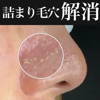 マツヤニワックス専門 堂山町 ルミエールのエステ・リラクイメージ