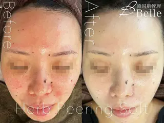 Belle広島 渡邉のエステ・リラクイメージ