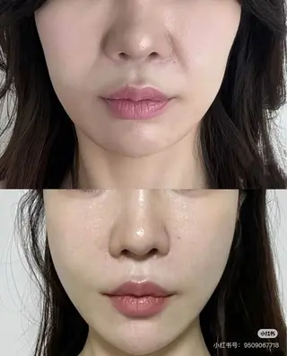 ネイル aliaハイフ&水光ジェットサロン所属・aliaハーブ水光店 エステティシャン募集のエステ・リラクイメージ