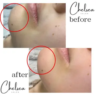 Chelsea所属・Chelsea 政　千尋のエステ・リラクイメージ