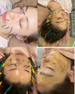 美容鍼灸サロン mahoroba院長のエステ・リラクイメージ