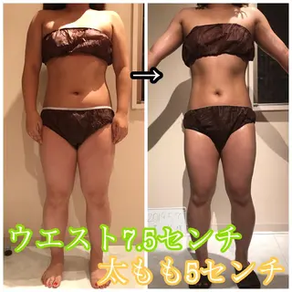 Cielo(シエロ) ダイエット専門店のエステ・リラクイメージ