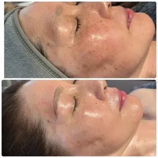 Beauty salon 705のエステ・リラクイメージ