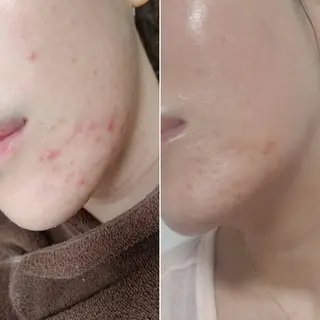 Froom sayaのエステ・リラクイメージ