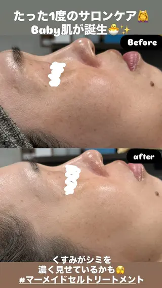 LiZA エステティックサロンのエステ・リラクイメージ