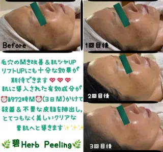 ヴィーナス ビューティーのエステ・リラクイメージ