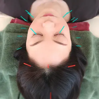 美身鍼灸はりごこち (大峰)のエステ・リラクイメージ