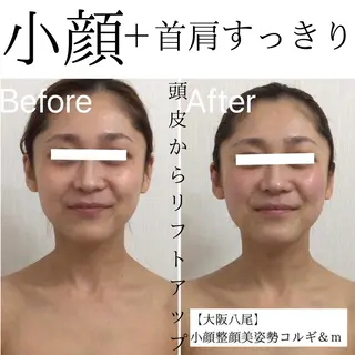 リフトアップ小顔 専門のエステ・リラクイメージ