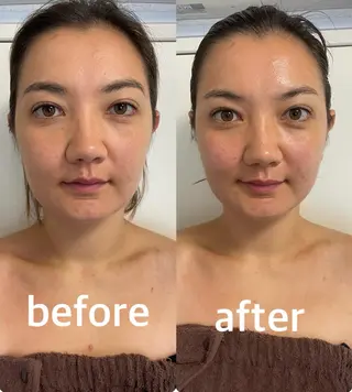 美容鍼灸サロン mahoroba院長のエステ・リラクイメージ