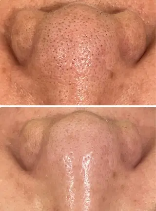 Nicore所属・肌質改善🌿まつ毛 chapiのその他イメージ