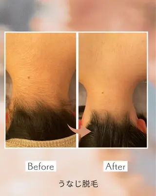 LONO  by a little所属・LONO byalittleのエステ・リラクイメージ