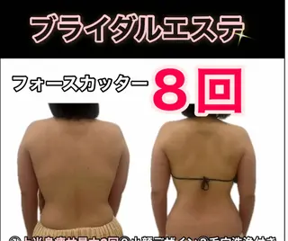 ブライダル痩身×脱毛 尼崎駅前サロンのエステ・リラクイメージ