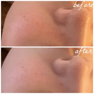 メンズ メナード岐阜市茜部 杉浦のエステ・リラクイメージ