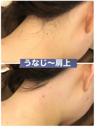 メンズ ブラジリアン☆WAX 🎖🌚YUKI🌚のエステ・リラクイメージ