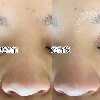 毛穴専門サロン　フルール所属・フルールFululu 自由が丘のエステ・リラクイメージ