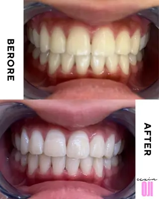 セルフホワイトニングサロン  エクシアホワイト 王寺店所属・エクシア王寺 NISHIKAWAのその他イメージ