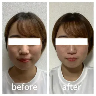 小顔サロン AMYONのエステ・リラクイメージ