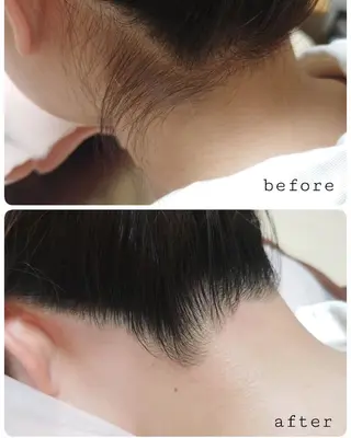 ブラジリアンワックス 脱毛 キナリのエステ・リラクイメージ