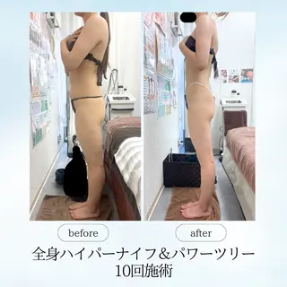 espresso,所属・《痩身、小顔専門店》 エスプレッソのエステ・リラクイメージ