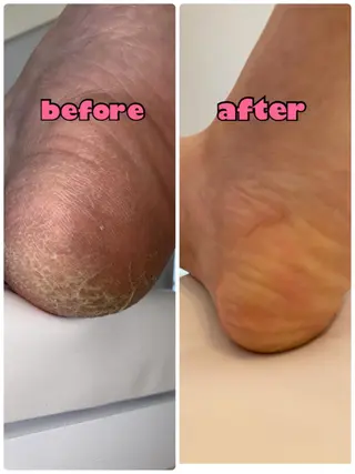 ネイル 芦原 嘉子のネイルデザイン