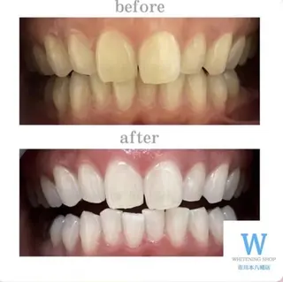 ホワイトニング ショップ本八幡店のエステ・リラクイメージ