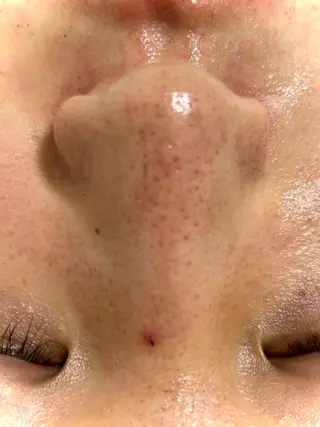 麻布十番エステサロン WhiteAzabuのエステ・リラクイメージ