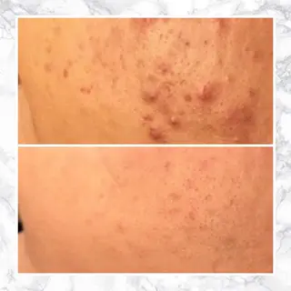 セミロング カラー パーマ ヘアアレンジ メンズ キッズ ネイル マツエク・マツパ アイブロウ 触れたくなる モテ肌へ...❤︎のエステ・リラクイメージ