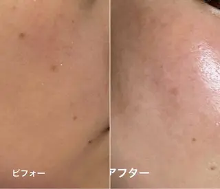 エステサロン藍月所属・エステサロン 藍月レイクタウンのエステ・リラクイメージ