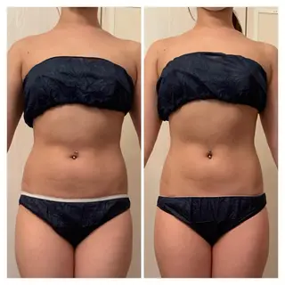 食べながら魅せボディ éclatJua川越のエステ・リラクイメージ