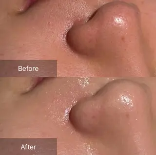 for woman所属・森 美優のエステ・リラクイメージ