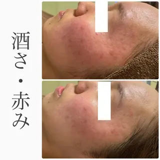 ハーブピーリング専門 BIOEL横浜のエステ・リラクイメージ