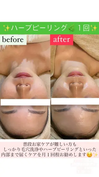 Salon de Lino 御器所のエステ・リラクイメージ