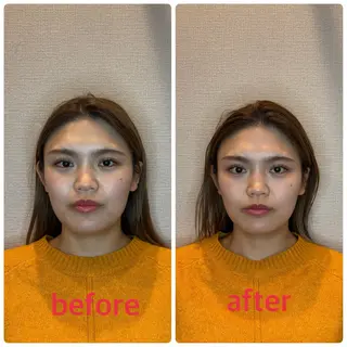 小林整骨院本町 美容鍼roomのエステ・リラクイメージ