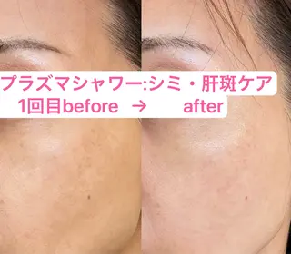 エレガンテ　ビューティーサロン所属・🎀エレガンテ🎀 美肌専門👸本間のその他イメージ