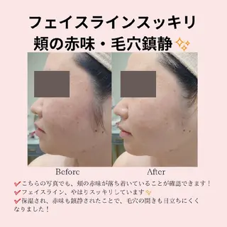 PRETTIEST SHINE所属・フェイシャル/ボディ /ブライダル山田浩子のエステ・リラクイメージ