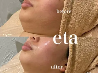 ネイル 💋美ボディサロン eta【エタ】💋のエステ・リラクイメージ