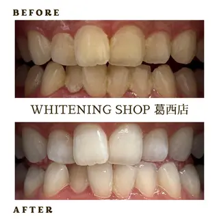 メンズ ホワイトニング ショップ葛西店のその他イメージ