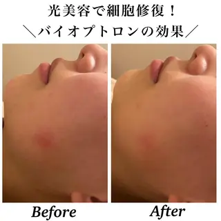 Bellesthe （ベルエステ）のエステ・リラクイメージ