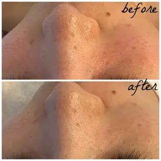 メンズ メナード岐阜市茜部 杉浦のエステ・リラクイメージ